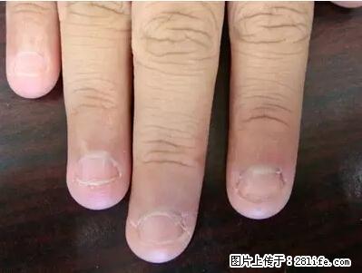 剪指甲、挖耳屎，这些日常小动作竟隐藏大危害！ - 丽江生活资讯 - 丽江28生活网 lj.28life.net